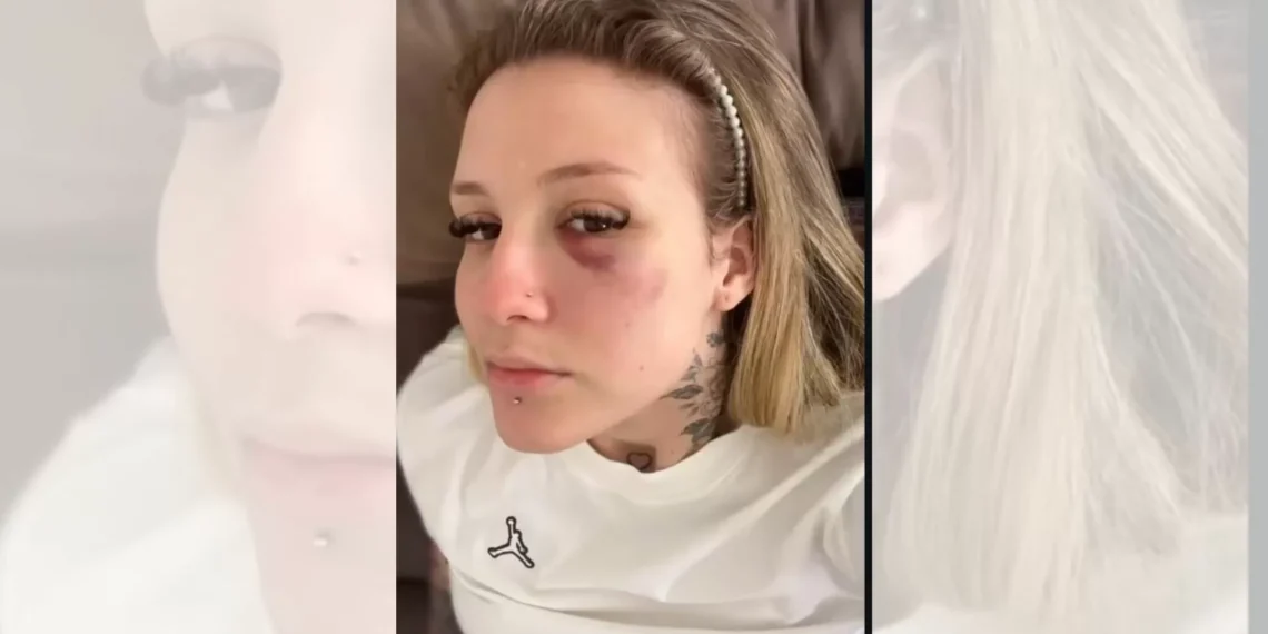 Polícia vai ouvir ex-namorada de Caio Paulista sobre denúncia de agressão