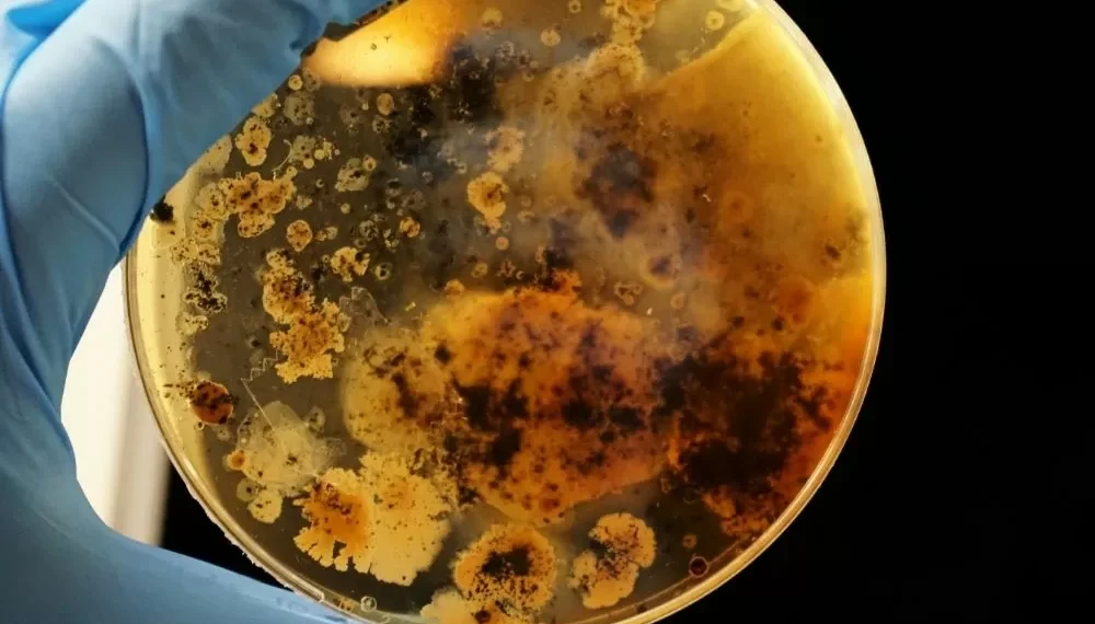 Uma em cada seis infecções bacterianas no mundo é resistente a antibióticos, alerta OMS