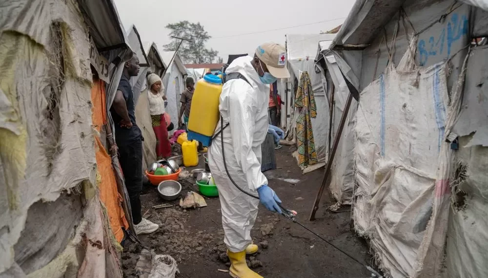 Nova variante da mpox é descoberta na Inglaterra